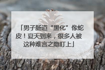 男子肠道“黑化”像蛇皮！夏天到来，很多人被这种难言之隐盯上