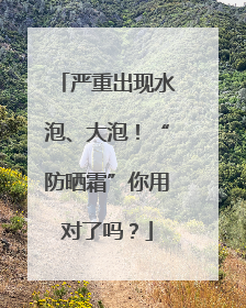 严重出现水泡、大泡！“防晒霜”你用对了吗？